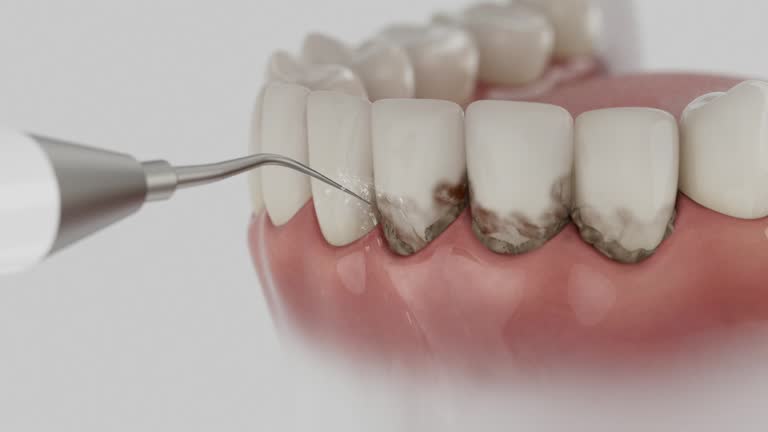 Reliable Dental contractor in Morgan County County, MO by Dentist Open Now